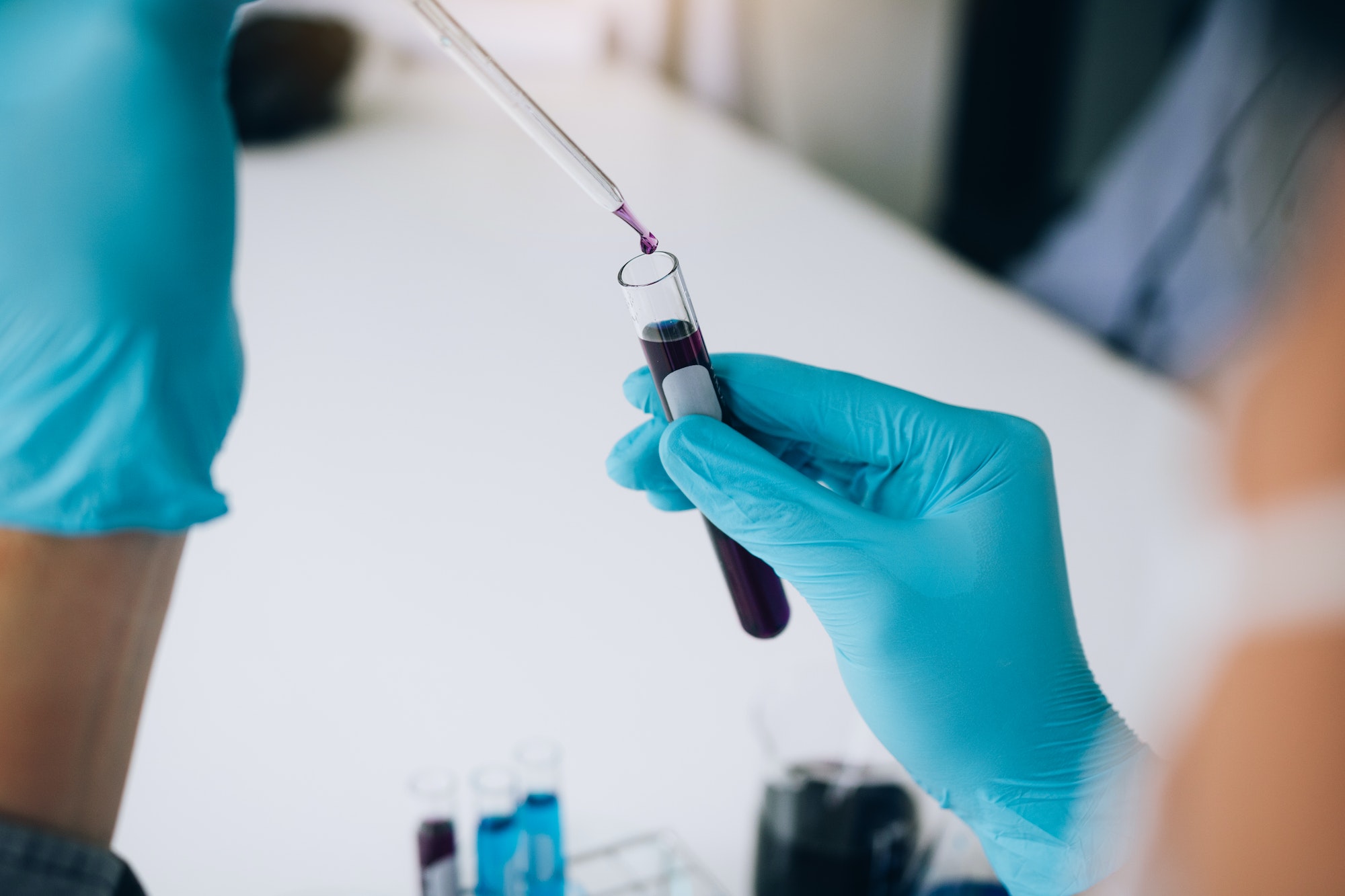 Chemist scientist conducts experiments by synthesising compounds with using dropper in a test tube.