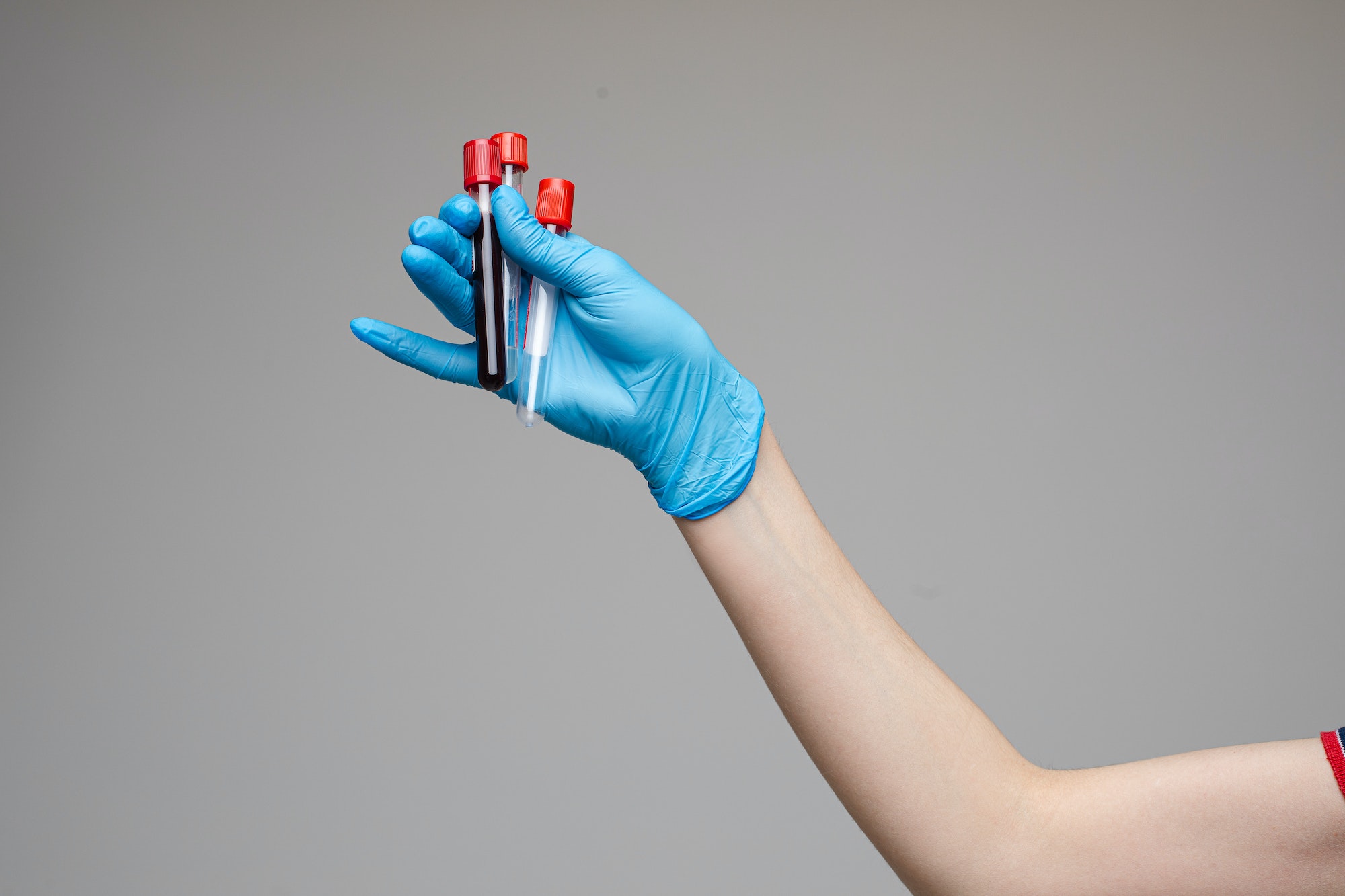 Doctor with blood tests in tube. Studio shot